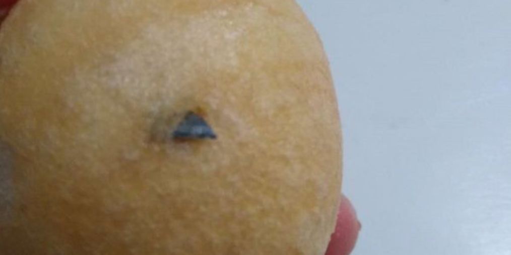 清美油面筋里＂藏＂刀片!83岁老伯苦等3月无答复